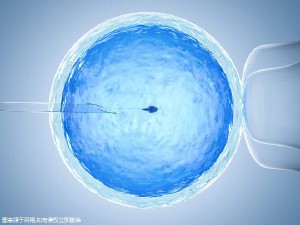 染色体易位